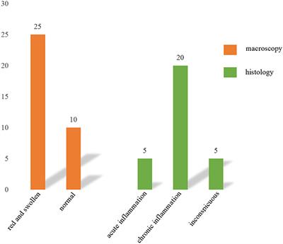 A retrospective study about incidental appendectomy during the laparoscopic treatment of intussusception